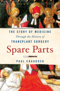 Spare Parts: the Story of Medicine Through the History of Transplant Surgery
